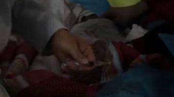 脚底打针视频,视频带你了解这一独特注射技巧